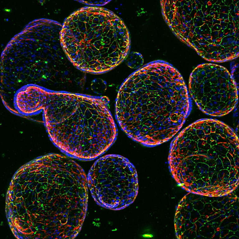 تصویر مدل سه‌بعدی کشت سلولی‌ (۳D Cell Culture)، شامل اسفروئیدها و ساختارهای ارگانوئید برای تحقیق سرطان و توسعه دارو